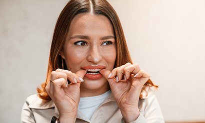 Patient putting clear aligners on in office