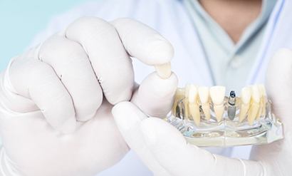 a dentist showing the dental crown for the implant
