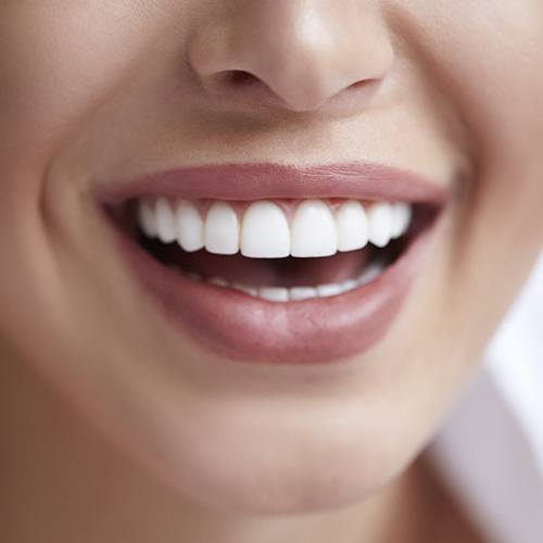 smile with veneers