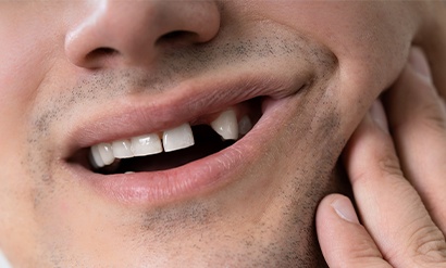 knocked out tooth