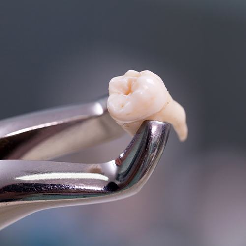 extracted tooth