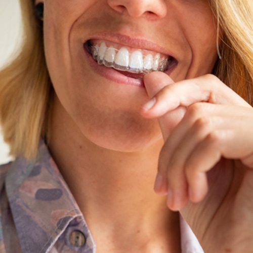 woman putting in Invisalign tray 